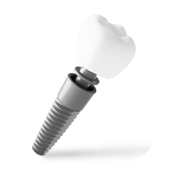 Top Rated Dental Implant Solutions